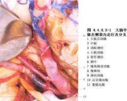 颞浅动脉旁注射视频